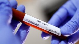 Dua orang WNI dipastikan terinveksi virus Corona (Covid-19) di Indonesia. Mereka merupakan warga yang tinggal di daerah Depok, Jawa Barat.