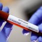 Dua orang WNI dipastikan terinveksi virus Corona (Covid-19) di Indonesia. Mereka merupakan warga yang tinggal di daerah Depok, Jawa Barat.